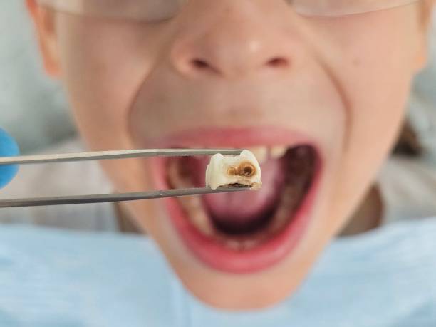 Best Broken or Cracked Tooth Emergency Dentist in Bayou La Batre, AL