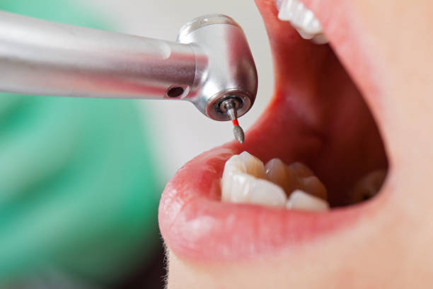Best Pediatric Emergency Dentist in Bayou La Batre, AL